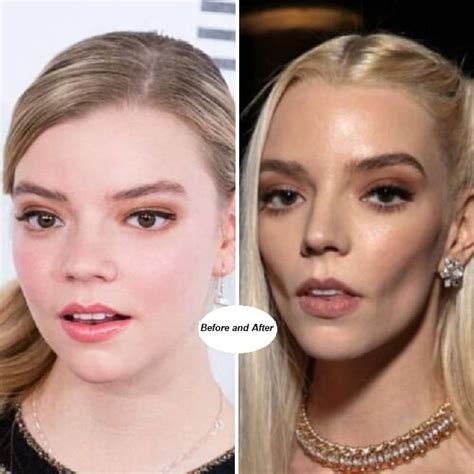 anya taylor-joy teeth|The Stunning Features Of Anya Taylor